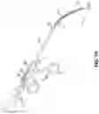 Fig. 10 - Endoscopic balloon dilator systems