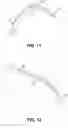 Fig. 11 - Endoscopic balloon dilator systems