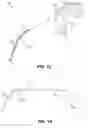 Fig. 12 - Endoscopic balloon dilator systems