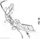 Fig. 29 - Endoscopic balloon dilator systems