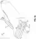 Fig. 37 - Endoscopic balloon dilator systems