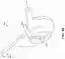 Fig. 40 - Endoscopic balloon dilator systems