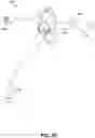 Fig. 42 - Endoscopic balloon dilator systems