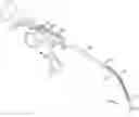 Fig. 01 - Endoscopic balloon dilator systems