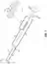 Fig. 02 - Endoscopic balloon dilator systems