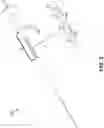 Fig. 04 - Endoscopic balloon dilator systems