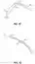 Fig. 11 - Endoscopic balloon dilator systems