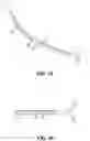 Fig. 13 - Endoscopic balloon dilator systems
