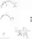 Fig. 20 - Endoscopic balloon dilator systems