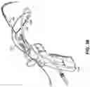 Fig. 29 - Endoscopic balloon dilator systems