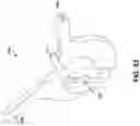 Fig. 40 - Endoscopic balloon dilator systems