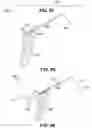 Fig. 44 - Endoscopic balloon dilator systems