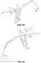 Fig. 45 - Endoscopic balloon dilator systems