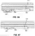 Fig. 47 - Endoscopic balloon dilator systems