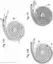 Fig. 09 - Implants for localized drug delivery and methods of use thereof