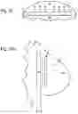 Fig. 10 - Implants for localized drug delivery and methods of use thereof