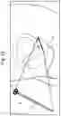 Fig. 13 - Implants for localized drug delivery and methods of use thereof