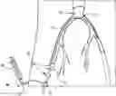 Fig. 01 - VASCULAR ACCESS SHEATH AND CATHETER SYSTEM