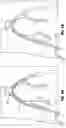 Fig. 03 - VASCULAR ACCESS SHEATH AND CATHETER SYSTEM