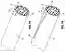 Fig. 11 - VASCULAR ACCESS SHEATH AND CATHETER SYSTEM
