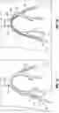 Fig. 19 - VASCULAR ACCESS SHEATH AND CATHETER SYSTEM
