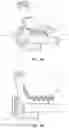 Fig. 04 - HEMOSTASIS VALVE DEVICE