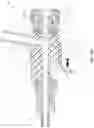 Fig. 11 - HEMOSTASIS VALVE DEVICE