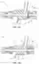 Fig. 18 - HEMOSTASIS VALVE DEVICE