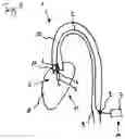 Fig. 02 - Blood pump