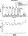 Fig. 13 - Systems and methods for estimating a position of a heart pump
