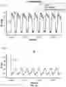 Fig. 14 - Systems and methods for estimating a position of a heart pump