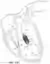 Fig. 49 - PULSATILITY DETECTION