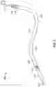 Fig. 03 - SYSTEMS AND METHODS FOR DETERMINING POSITIONING OF INTRACARDIAC DEVICES