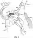 Fig. 07 - SYSTEMS AND METHODS FOR DETERMINING POSITIONING OF INTRACARDIAC DEVICES