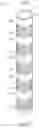 Fig. 08 - Neuromodulation probe