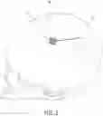 Fig. 04 - Burr hole plug