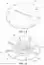 Fig. 10 - Burr hole plug