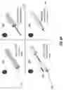 Fig. 07 - Implantable peripheral nerve stimulation lead