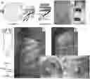 Fig. 01 - State-dependent pudendal nerve stimulation for bladder control
