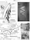 Fig. 13 - State-dependent pudendal nerve stimulation for bladder control