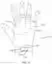 Fig. 32 - CURRENT STIMULATION APPARATUS