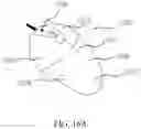 Fig. 33 - CURRENT STIMULATION APPARATUS