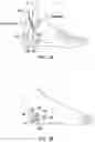 Fig. 02 - High frequency electrostimulation treatment for restless legs syndrome or periodic limb movement disorder