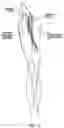 Fig. 04 - High frequency electrostimulation treatment for restless legs syndrome or periodic limb movement disorder