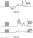 Fig. 10 - High frequency electrostimulation treatment for restless legs syndrome or periodic limb movement disorder