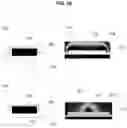 Fig. 17 - Micro device of nerve signal recording and stimulating for diagnosis and treatment of chronic pain or alzheimer's disease