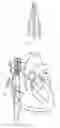 Fig. 06 - LEADLESS PACEMAKER AND LEADLESS PACEMAKER SYSTEM