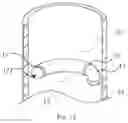 Fig. 07 - LEADLESS PACEMAKER AND LEADLESS PACEMAKER SYSTEM