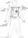 Fig. 01 - Wearable medical device with temperature managed electrodes