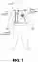 Fig. 02 - Wearable medical device with temperature managed electrodes